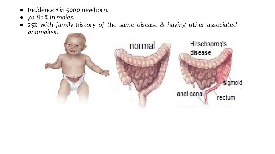  Incidence 1 in 5000 newborn. 70 -80 % in males. 25% with family