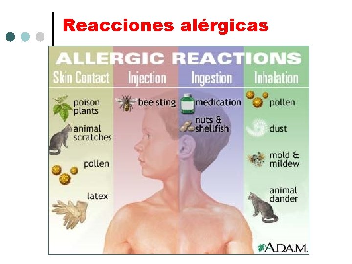 Reacciones alérgicas 