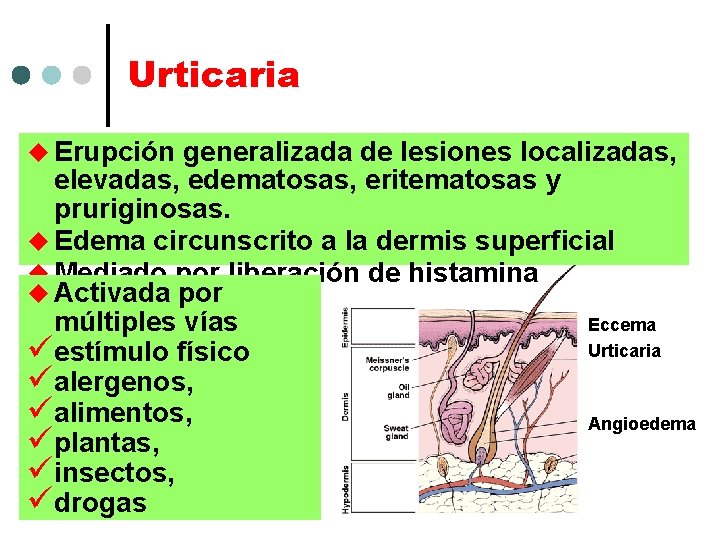Urticaria u Erupción generalizada de lesiones localizadas, elevadas, edematosas, eritematosas y pruriginosas. u Edema