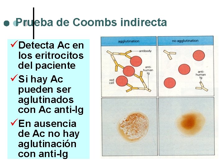 Prueba de Coombs indirecta üDetecta Ac en los eritrocitos del paciente üSi hay Ac