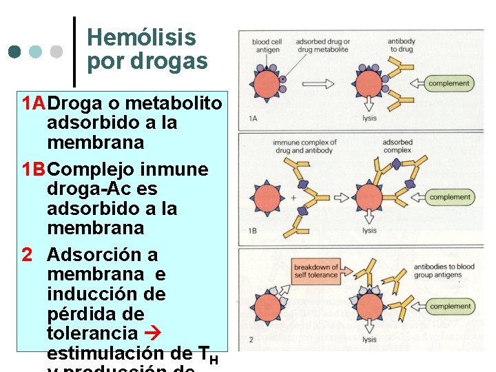 Hemólisis por drogas 1 ADroga o metabolito adsorbido a la membrana 1 BComplejo inmune