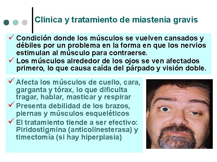 Clínica y tratamiento de miastenia gravis ü Condición donde los músculos se vuelven cansados