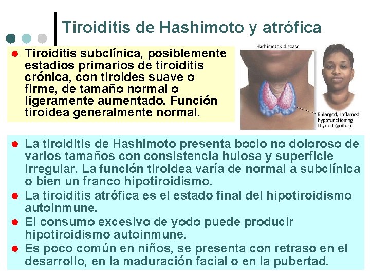 Tiroiditis de Hashimoto y atrófica l Tiroiditis subclínica, posiblemente estadios primarios de tiroiditis crónica,