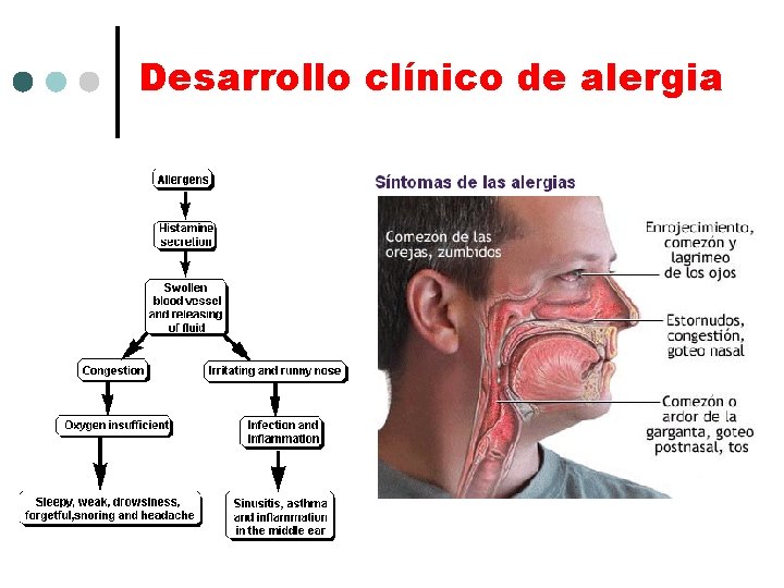 Desarrollo clínico de alergia 