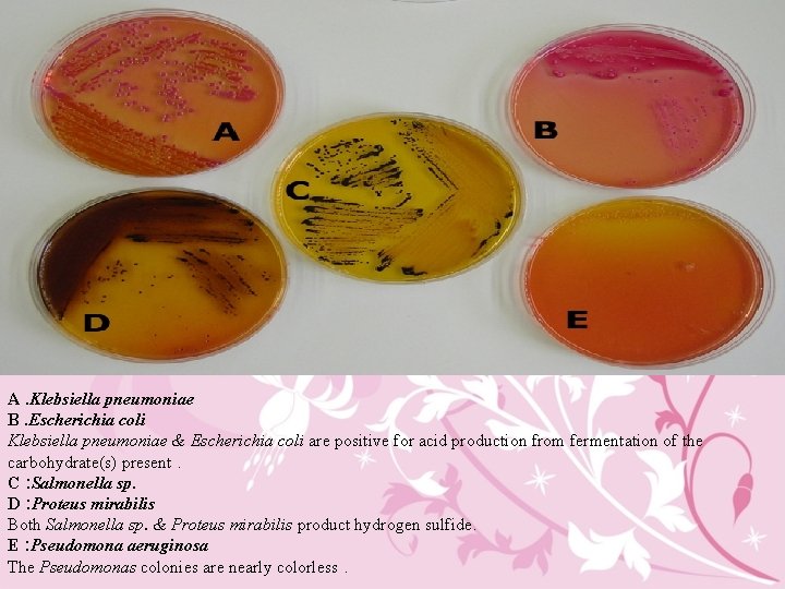 A. Klebsiella pneumoniae B. Escherichia coli Klebsiella pneumoniae & Escherichia coli are positive for