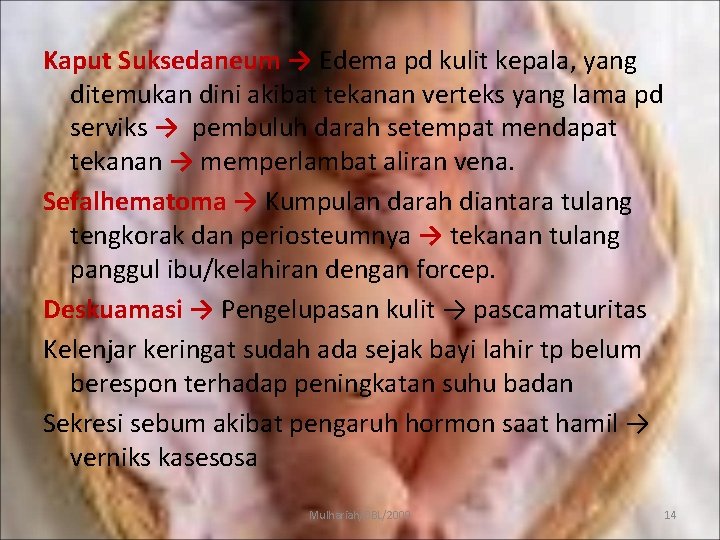 Kaput Suksedaneum → Edema pd kulit kepala, yang ditemukan dini akibat tekanan verteks yang