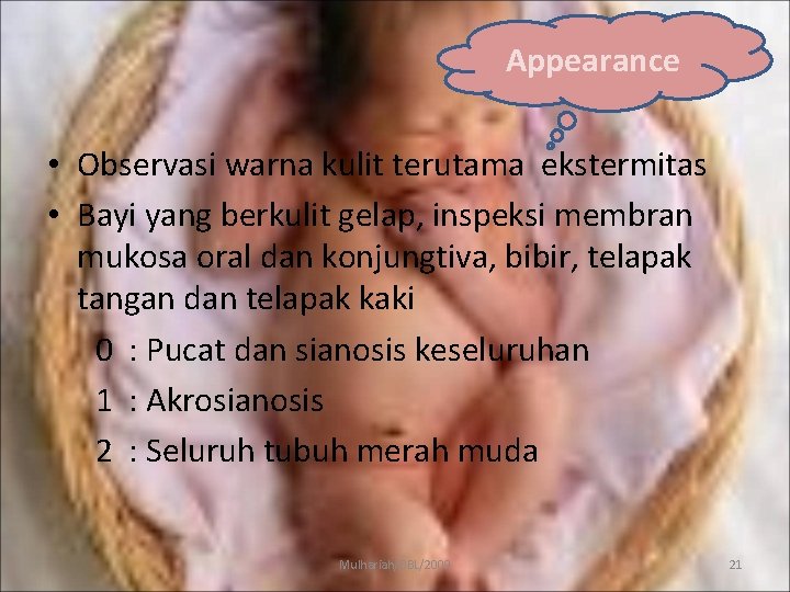 Appearance • Observasi warna kulit terutama ekstermitas • Bayi yang berkulit gelap, inspeksi membran