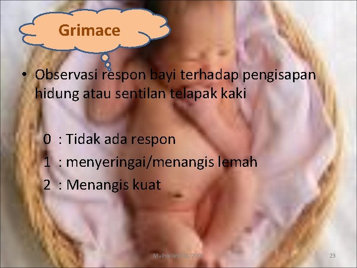 Grimace • Observasi respon bayi terhadap pengisapan hidung atau sentilan telapak kaki 0 :
