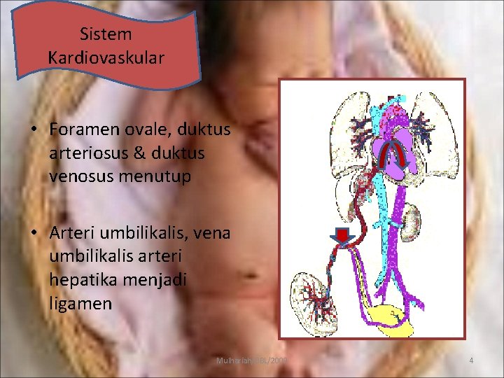 Sistem Kardiovaskular • Foramen ovale, duktus arteriosus & duktus venosus menutup • Arteri umbilikalis,