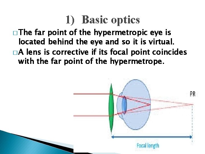 1) Basic optics � The far point of the hypermetropic eye is located behind