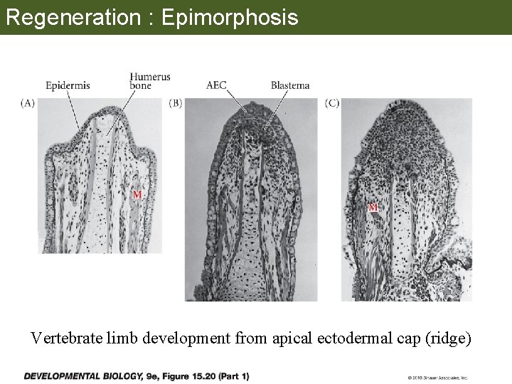 Regeneration : Epimorphosis Vertebrate limb development from apical ectodermal cap (ridge) 