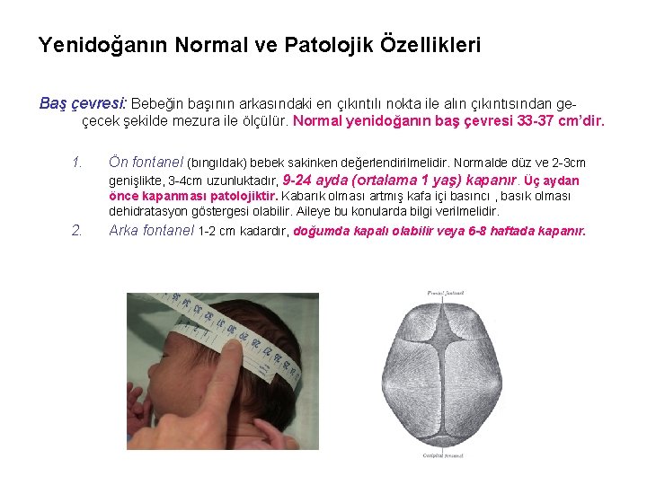 Yenidoğanın Normal ve Patolojik Özellikleri Baş çevresi: Bebeğin başının arkasındaki en çıkıntılı nokta ile