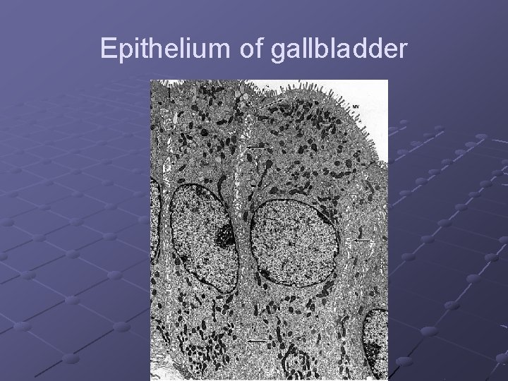 Epithelium of gallbladder 