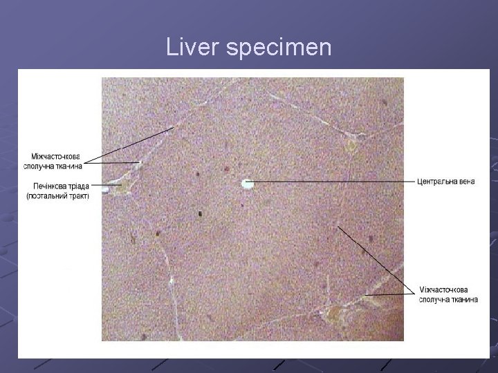 Liver specimen 