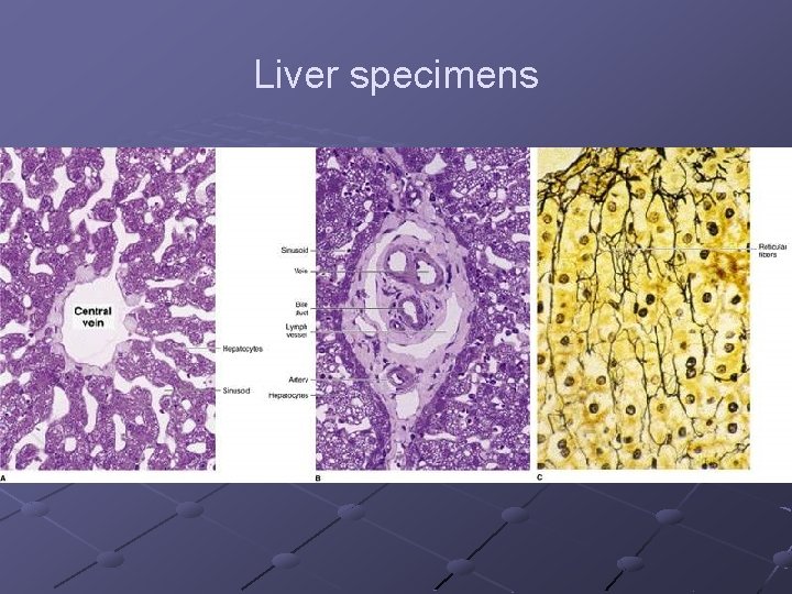 Liver specimens 