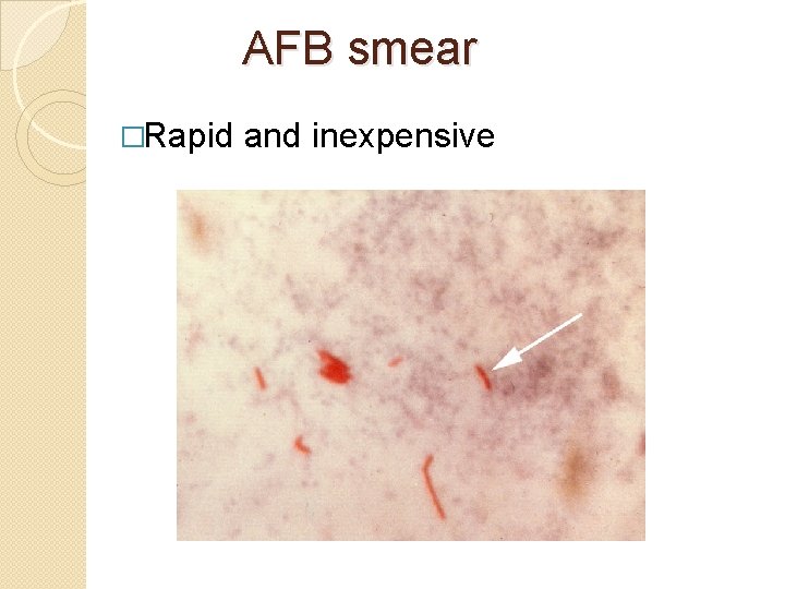 AFB smear �Rapid and inexpensive 