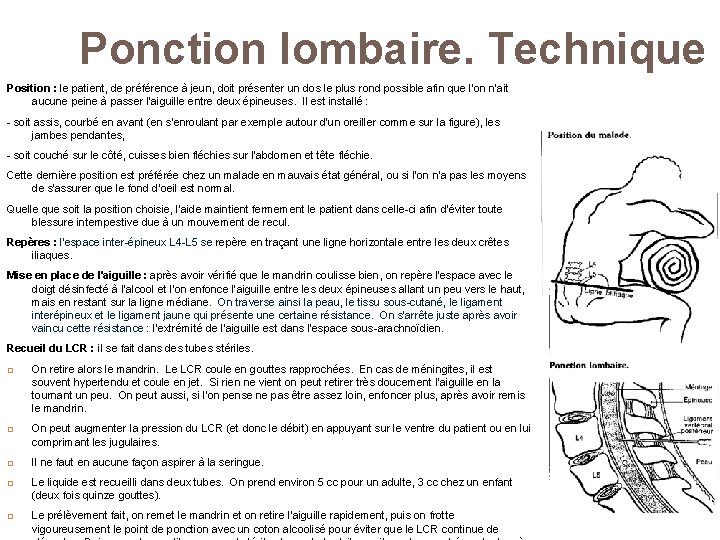 Ponction lombaire. Technique Position : le patient, de préférence à jeun, doit présenter un