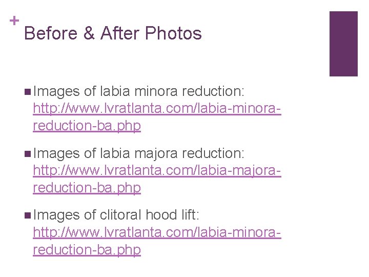 + Before & After Photos n Images of labia minora reduction: http: //www. lvratlanta.