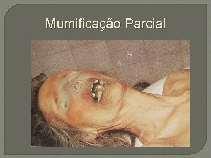 Mumificação Parcial 