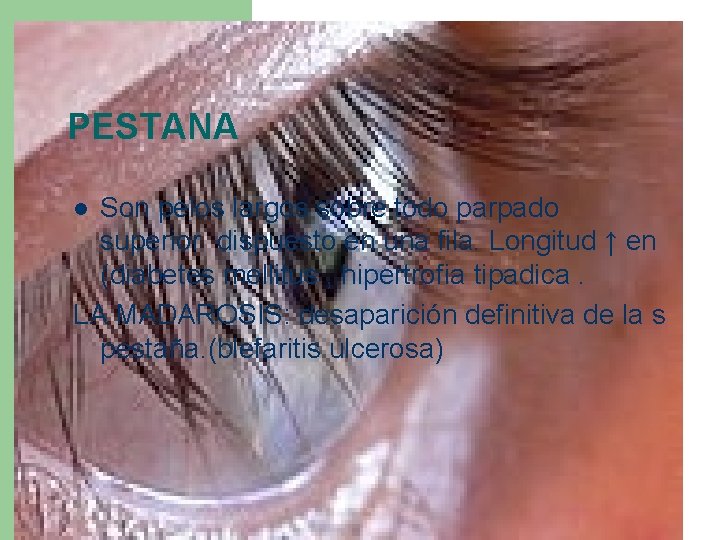 PESTANA Son pelos largos sobre todo parpado superior dispuesto en una fila. Longitud ↑