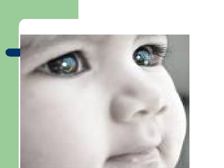 GLOBO OCULAR 