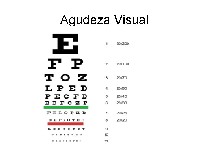 Agudeza Visual 