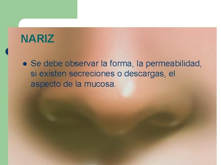 NARIZ l Se debe observar la forma, la permeabilidad, si existen secreciones o descargas,