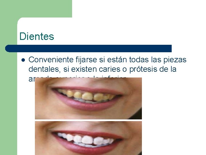 Dientes l Conveniente fijarse si están todas las piezas dentales, si existen caries o
