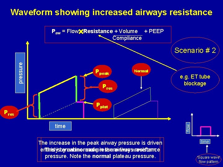 Waveform showing increased airways resistance Paw = Flow Resistance + Volume + PEEP Compliance