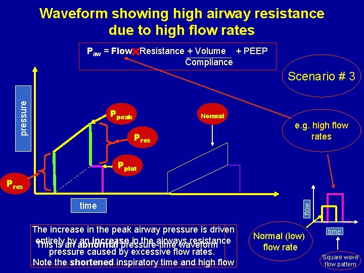 Waveform showing high airway resistance due to high flow rates Paw = Flow Resistance