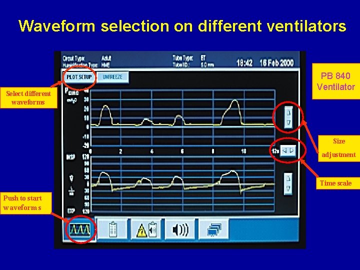 Waveform selection on different ventilators Select different waveforms PB 840 Ventilator Size adjustment Time Waveform selection on different ventilators Select different waveforms PB 840 Ventilator Size adjustment Time