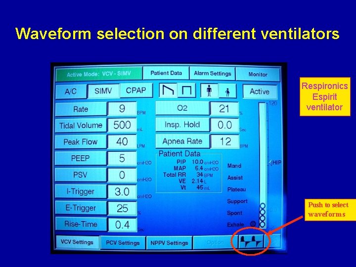 Waveform selection on different ventilators Respironics Espirit ventilator Push to select waveforms 