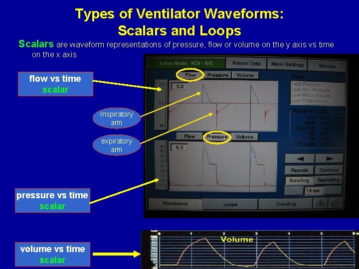 Types of Ventilator Waveforms: Scalars and Loops Scalars are waveform representations of pressure, flow