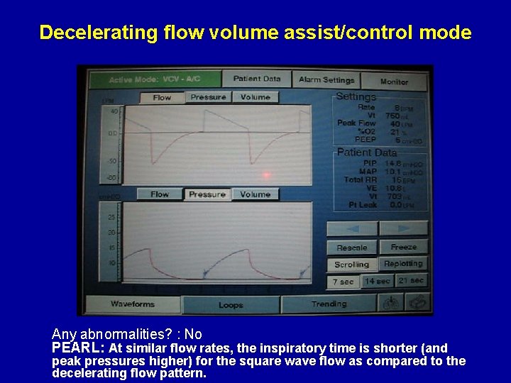 Decelerating flow volume assist/control mode Any abnormalities? : No PEARL: At similar flow rates,