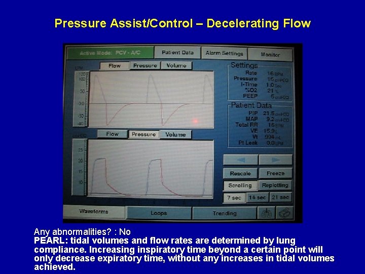 Pressure Assist/Control – Decelerating Flow Any abnormalities? : No PEARL: tidal volumes and flow