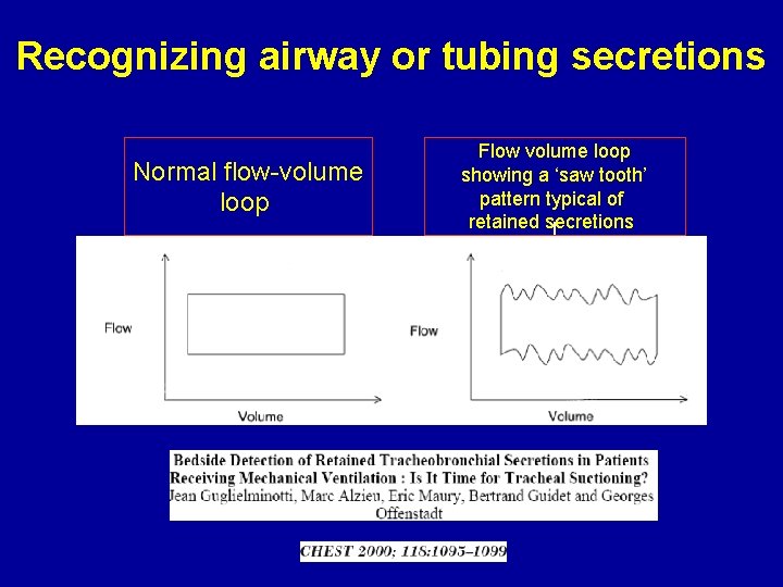 Recognizing airway or tubing secretions Normal flow-volume loop Flow volume loop showing a ‘saw