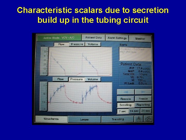 Characteristic scalars due to secretion build up in the tubing circuit 