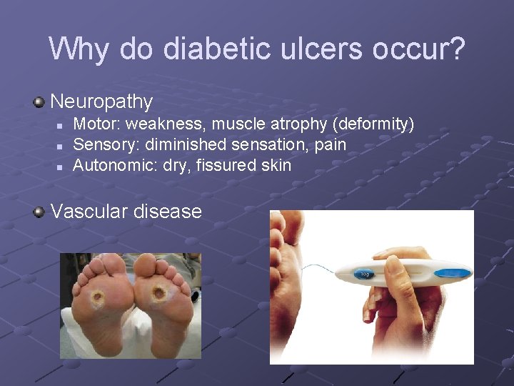 Why do diabetic ulcers occur? Neuropathy n n n Motor: weakness, muscle atrophy (deformity)