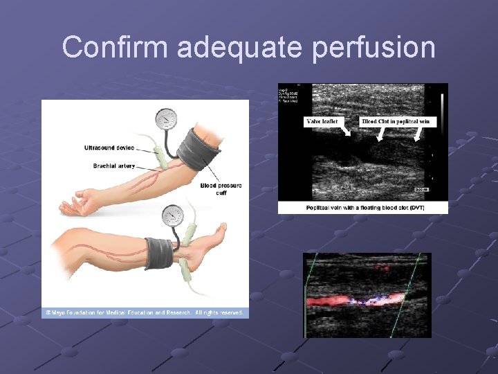 Confirm adequate perfusion Confirm adequate perfusion