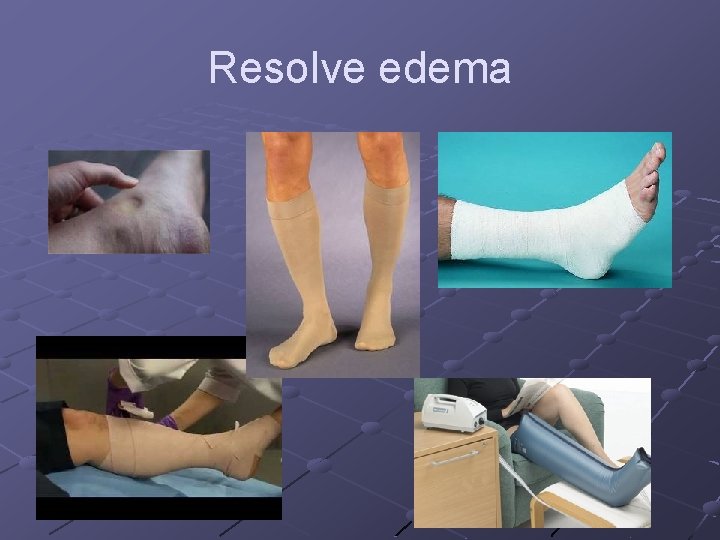Resolve edema Resolve edema