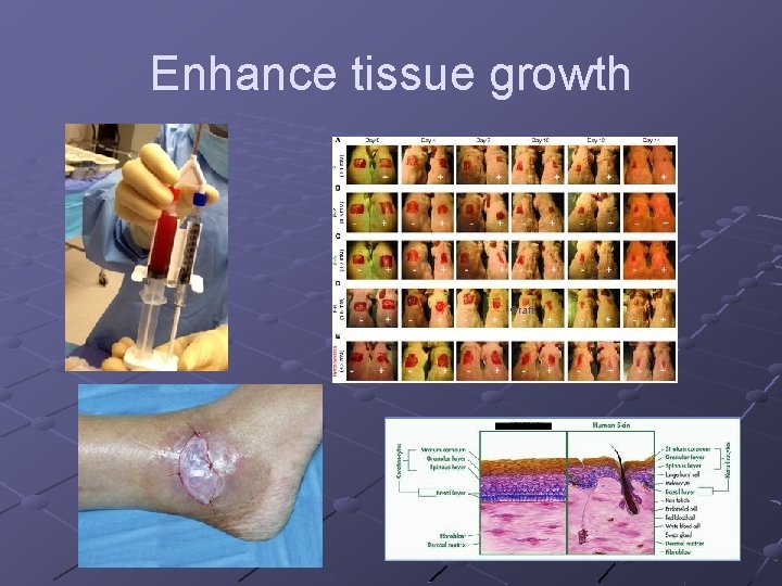 Enhance tissue growth Graft Enhance tissue growth Graft