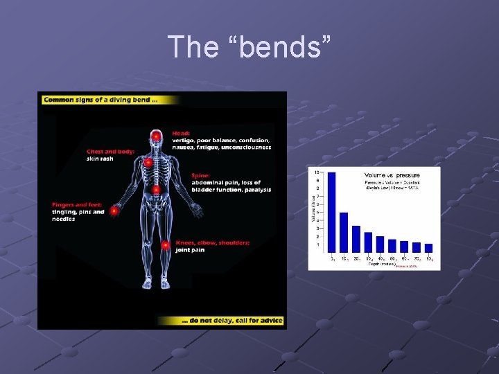 The “bends” The “bends”