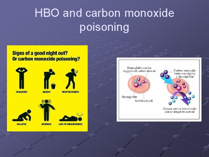 HBO and carbon monoxide poisoning 