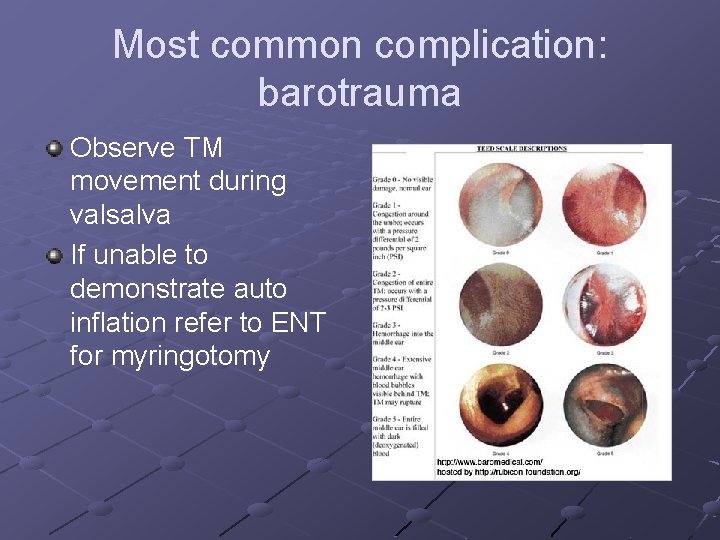 Most common complication: barotrauma Observe TM movement during valsalva If unable to demonstrate auto