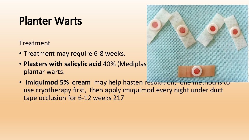 Planter Warts Treatment • Treatment may require 6 -8 weeks. • Plasters with salicylic