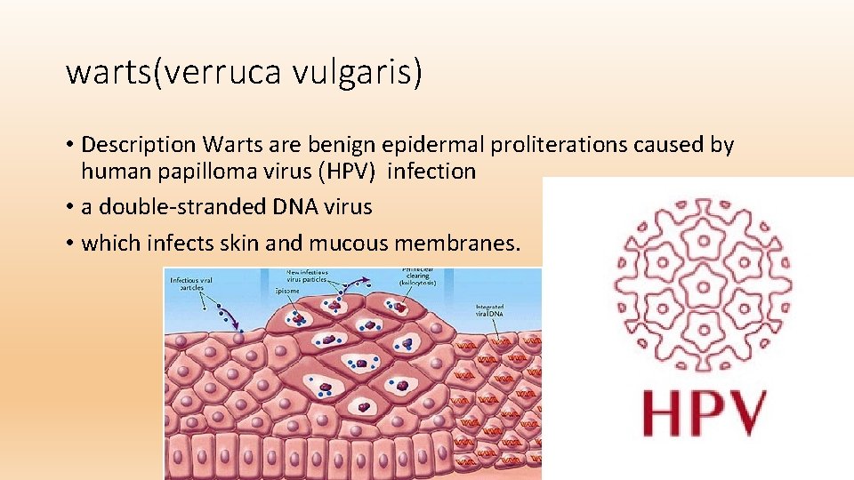 warts(verruca vulgaris) • Description Warts are benign epidermal proliterations caused by human papilloma virus