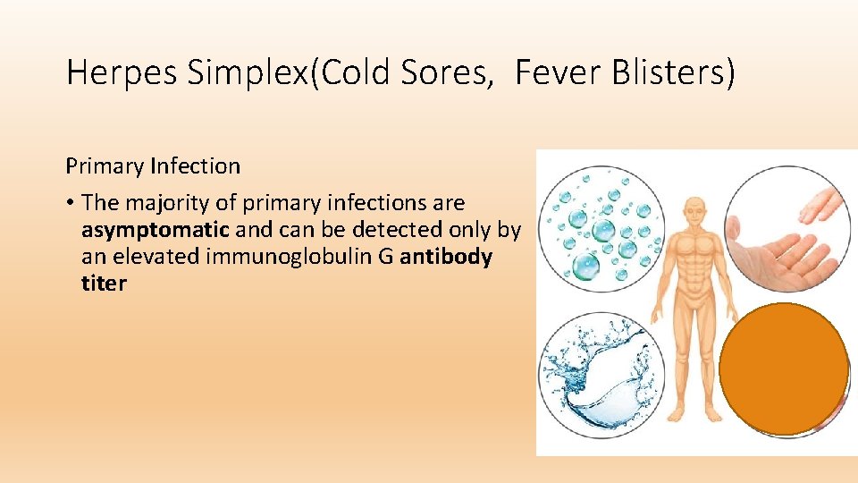 Herpes Simplex(Cold Sores, Fever Blisters) Primary Infection • The majority of primary infections are