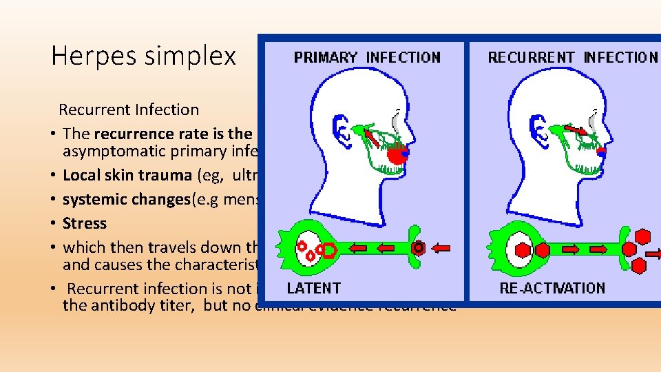 Herpes simplex Recurrent Infection • The recurrence rate is the same as for patients