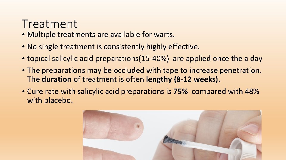 Treatment • Multiple treatments are available for warts. • No single treatment is consistently