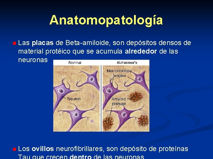 Anatomopatología n Las placas de Beta-amiloide, son depósitos densos de material protéico que se Anatomopatología n Las placas de Beta-amiloide, son depósitos densos de material protéico que se